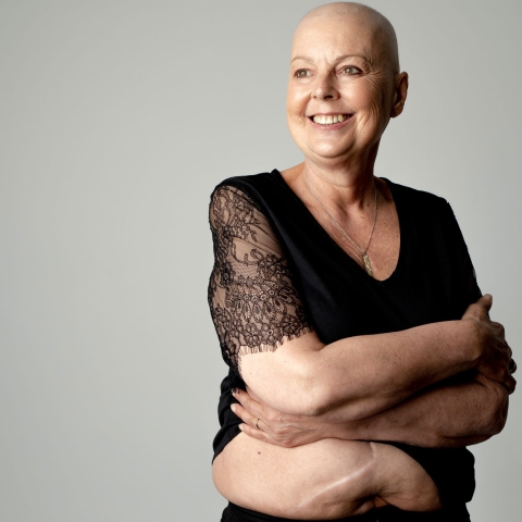 Barbara Hibbert, 61, who has stage 4 bowel cancer, is at the heart of powerful portrait series for Bowel Cancer UK’s national campaign