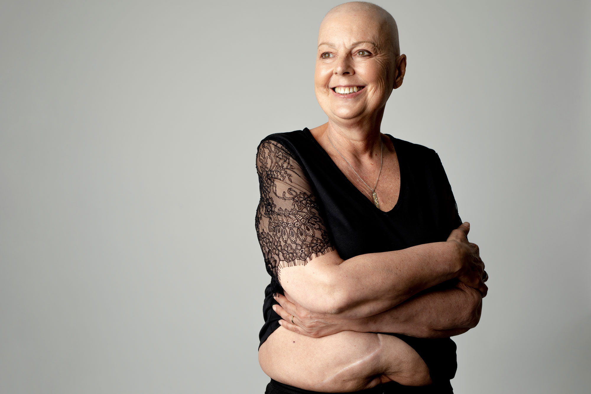 Barbara Hibbert, 61, who has stage 4 bowel cancer, is at the heart of powerful portrait series for Bowel Cancer UK’s national campaign