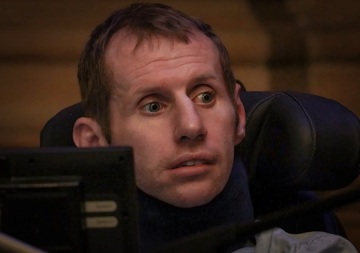 Rob Burrow